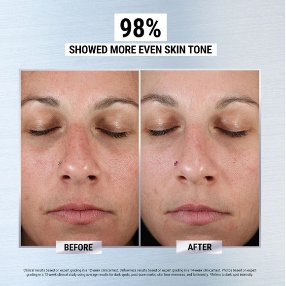 Brand New Kiehl's Clearly Corrective Dark Spot Solution Brightening Face Serum - Picture 12 of 16